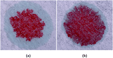 File:Blood typing by gel card method (column agglutination or MTS