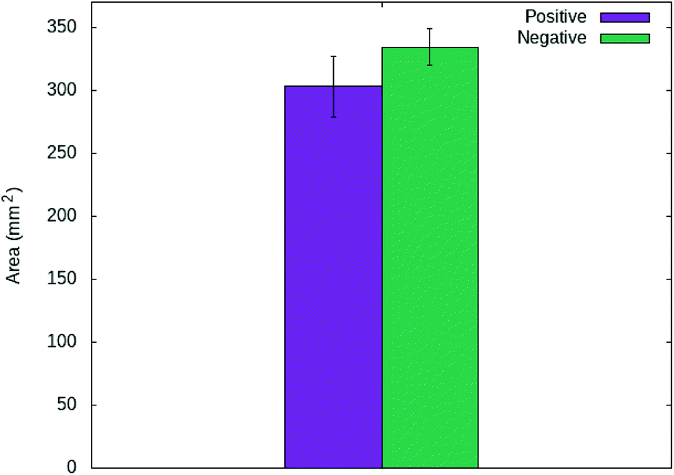 File:Blood typing by gel card method (column agglutination or MTS