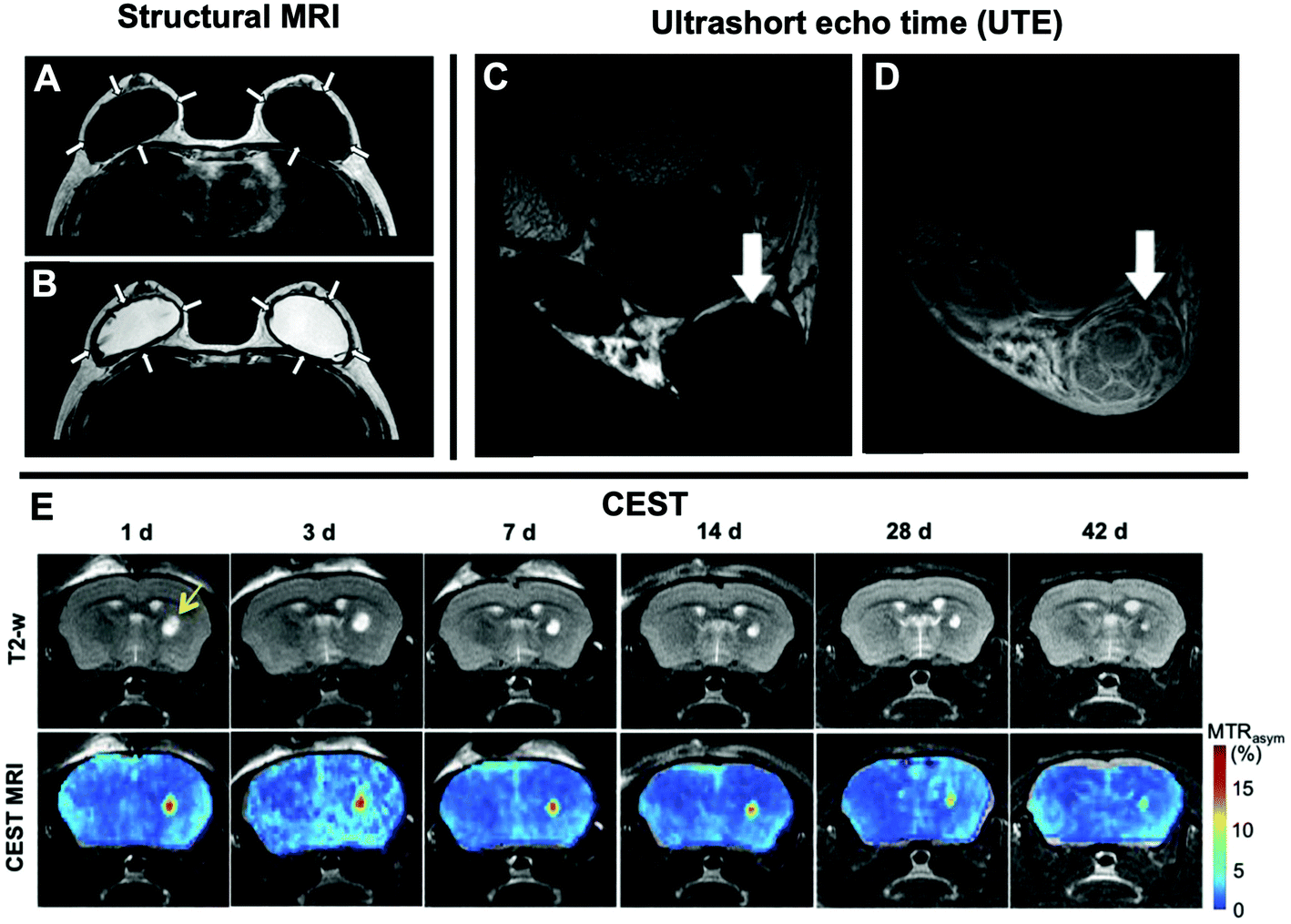 Medical Imaging Of Tissue Engineering And Regenerative Medicine Constructs Biomaterials Science Rsc Publishing Doi 10 1039 D0bm00705f