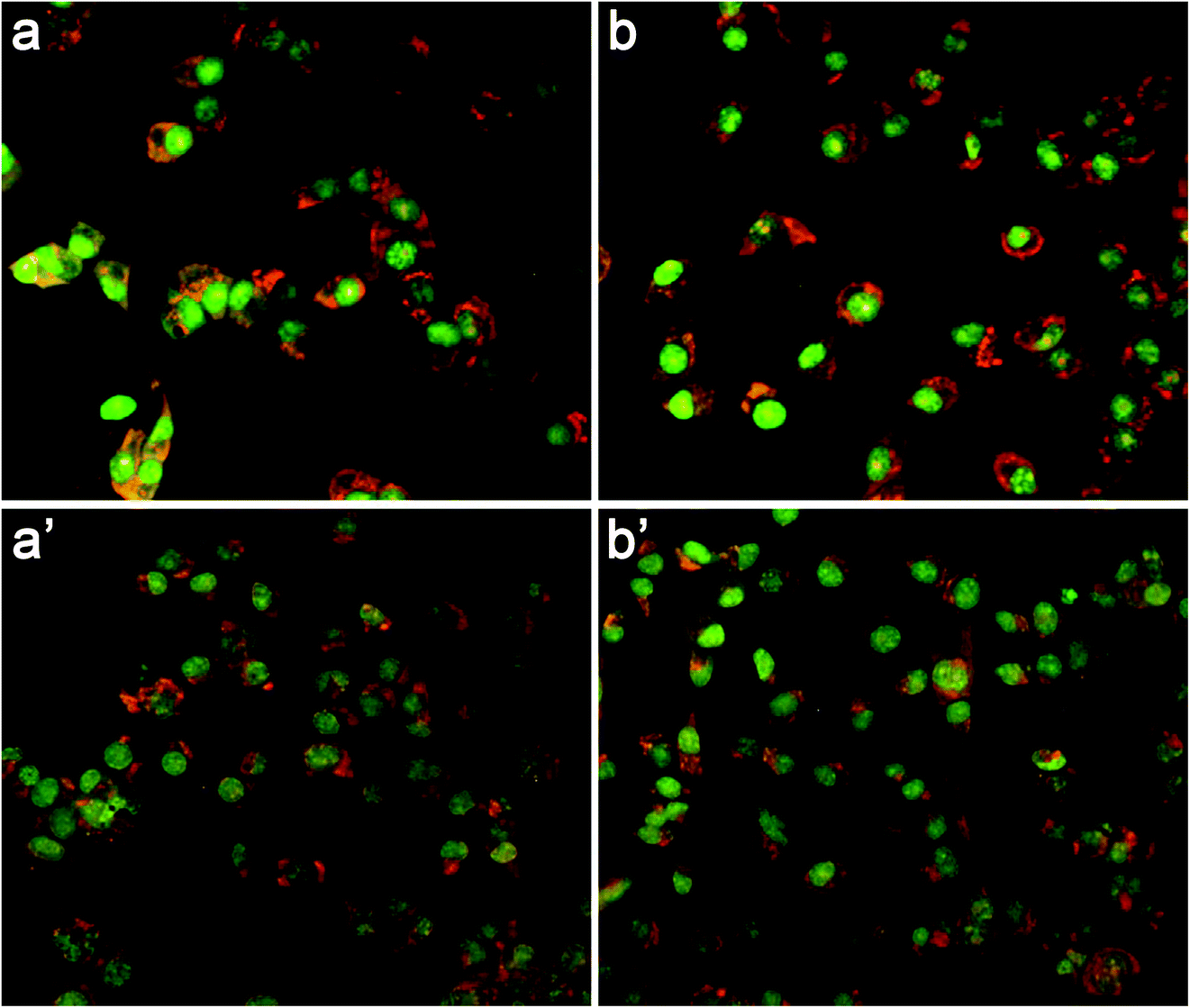 Isolation Of Extracellular Vesicles From Microalgae Towards The Production Of Sustainable And Natural Nanocarriers Of Bioactive Compounds Biomaterials Science Rsc Publishing Doi 10 1039 D0bma