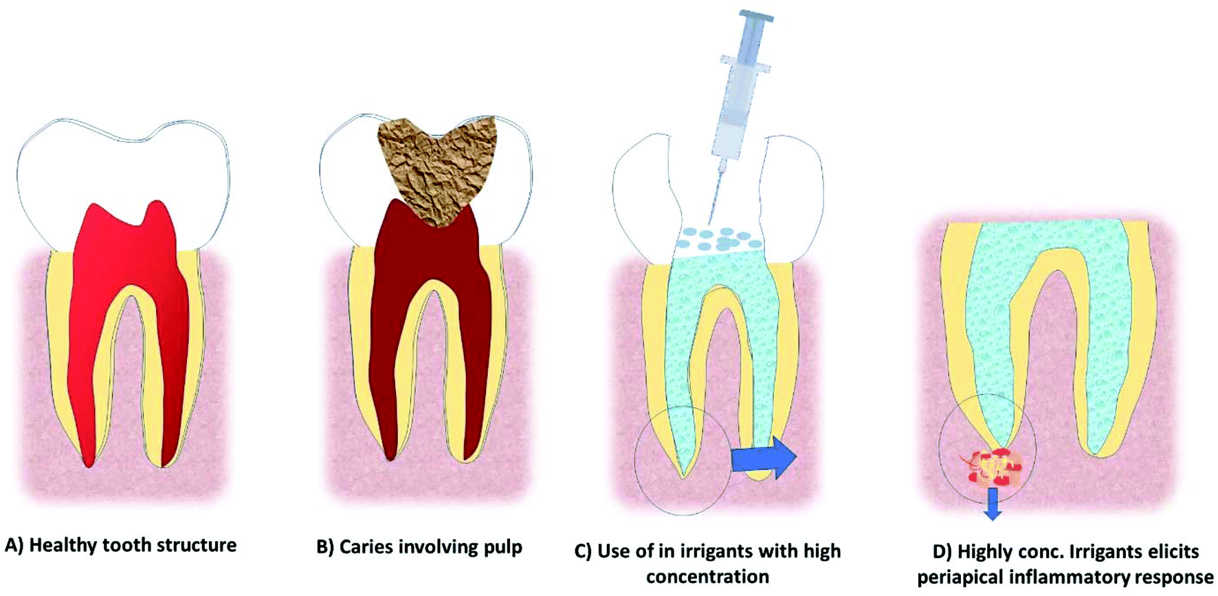 Recent Update On Potential Cytotoxicity Biocompatibility And Preventive Measures Of Biomaterials Used In Dentistry Biomaterials Science Rsc Publishing Doi 10 1039 D1bmc