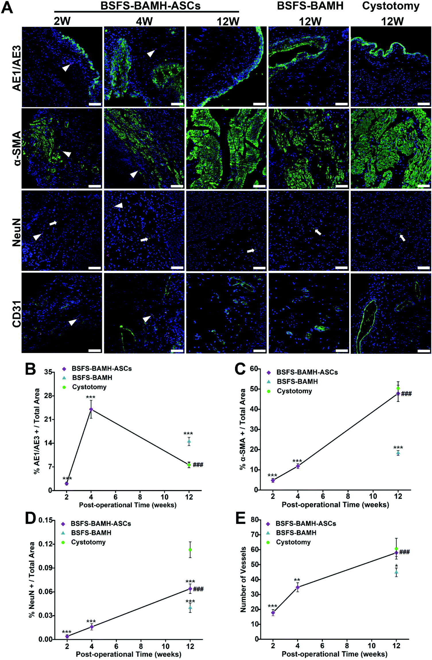 Bi-layer silk fibroin skeleton and bladder acellular matrix hydrogel  encapsulating adipose-derived stem cells for bladder reconstruction -  Biomaterials Science (RSC Publishing)