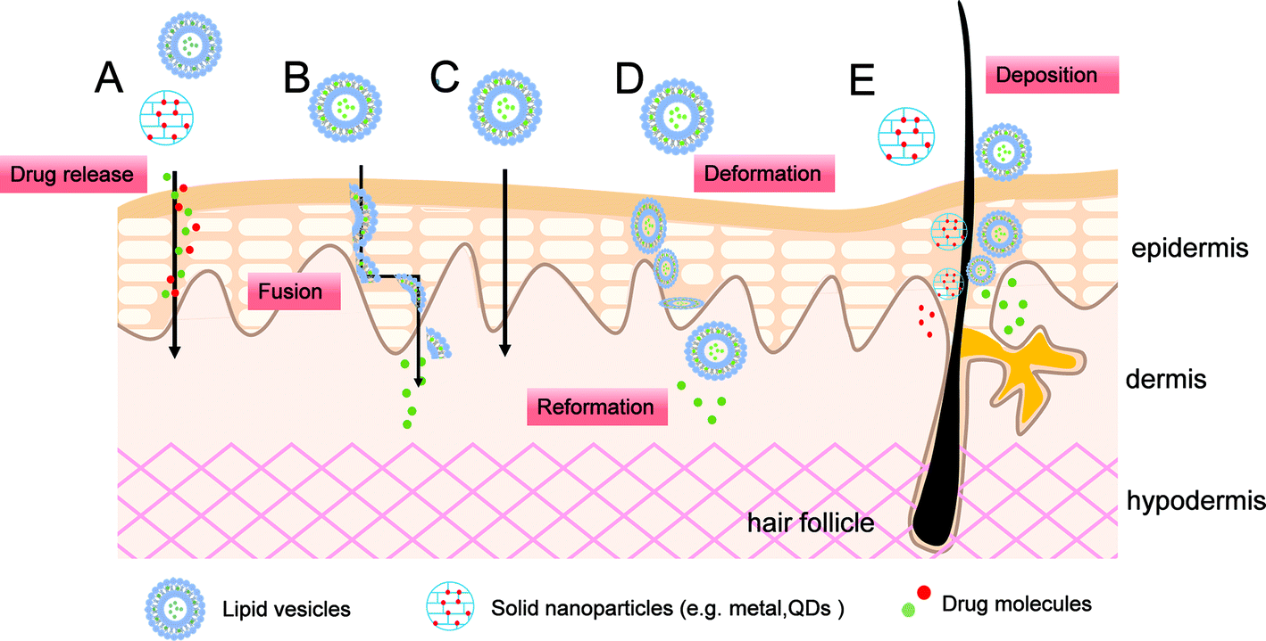 Nanodelivery Systems for Topical Management of Skin Disorders