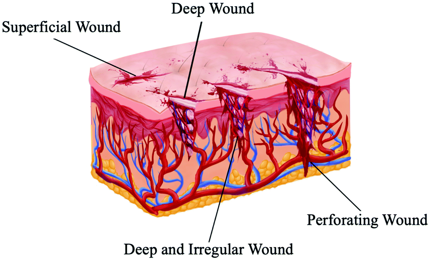 superficial wound