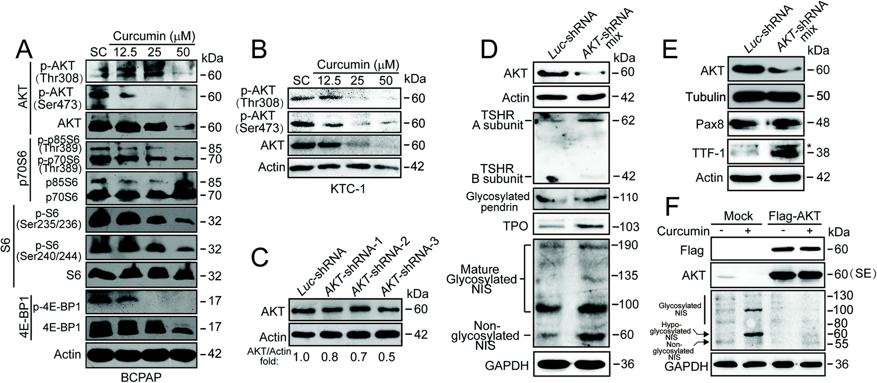 Curcumin enhances the membrane trafficking of the sodium iodide