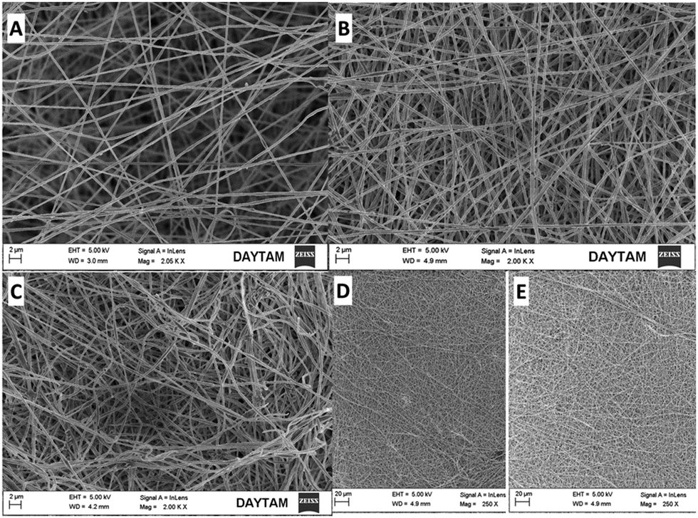 An Electrochemical Immunosensor Modified With Titanium Iv Oxide Polyacrylonitrile Nanofibers For The Determination Of A Carcinoembryonic Antigen New Journal Of Chemistry Rsc Publishing Doi 10 1039 D0njf