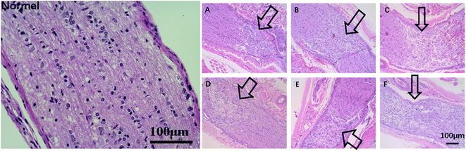 An adherent drug depot for retinal ganglion cell protection and ...