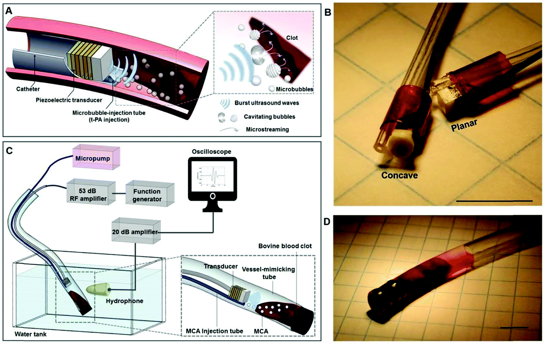 Cavitation and Radiofrequency - The Composite Bonding Company