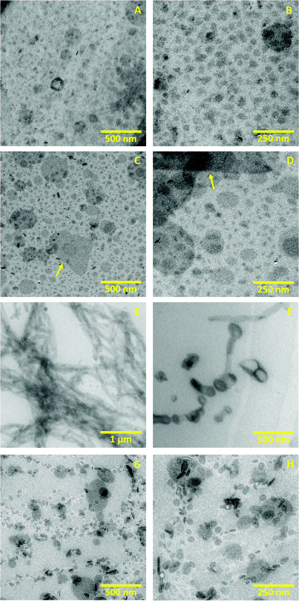 Electron microscopy and calorimetry of proteins in supercooled