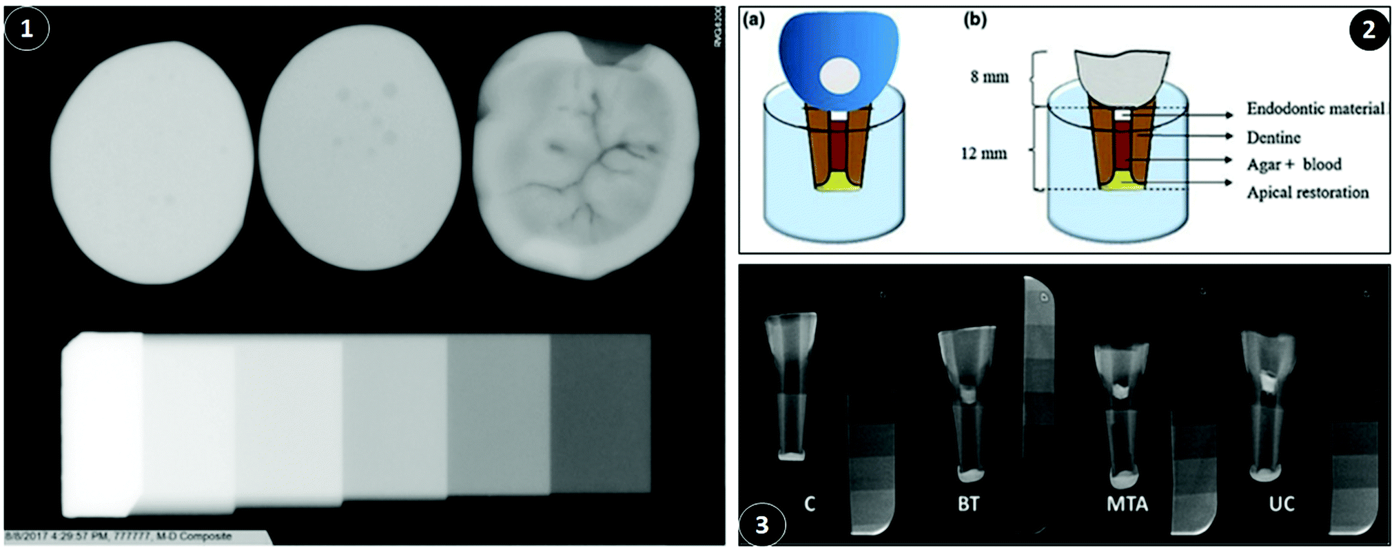 Intrinsically radiopaque biomaterial assortments: a short review on the  physical principles, X-ray imageability, and state-of-the-art developments  - Journal of Materials Chemistry B (RSC Publishing) DOI:10.1039/D1TB01513C