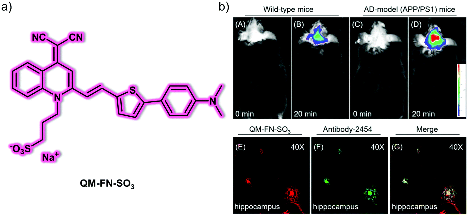 Smallmolecule fluorescencebased probes for interrogating major organ