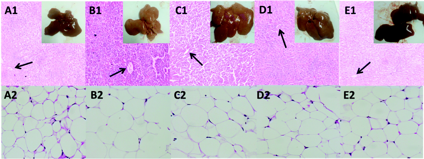 Retarding effect of dietary fibers from bamboo shoot (Phyllostachys edulis)  in hyperlipidemic rats induced by a high-fat diet - Food & Function (RSC  Publishing)
