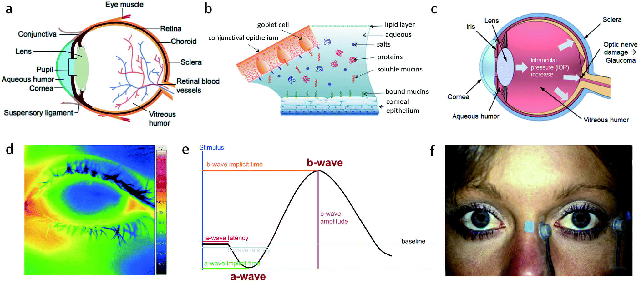 Recent Progress On Wearable Point Of Care Devices For Ocular Systems Lab On A Chip Rsc Publishing Recent Progress On Wearable Point Of Care Devices For Ocular Systems Lab On A Chip Rsc Publishing