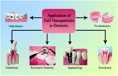 dentistry nanoparticles oxide zno rsc progress nps