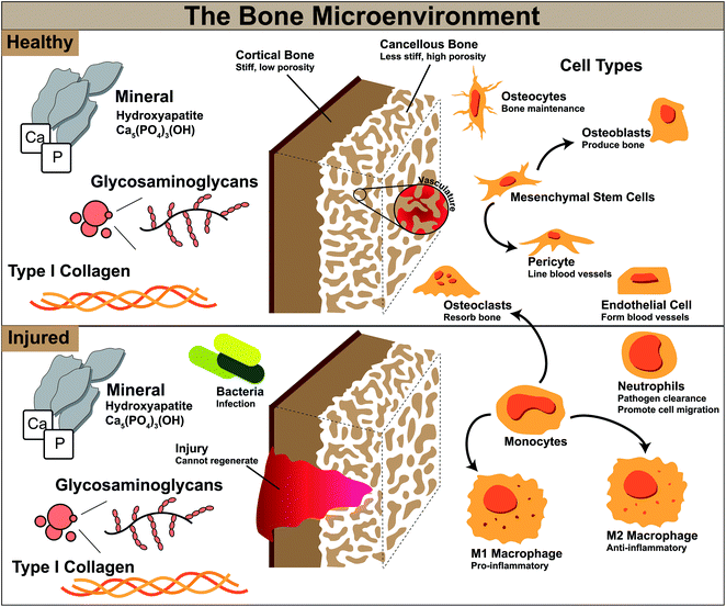 Biomaterial Design Strategies To Address Obstacles In ...