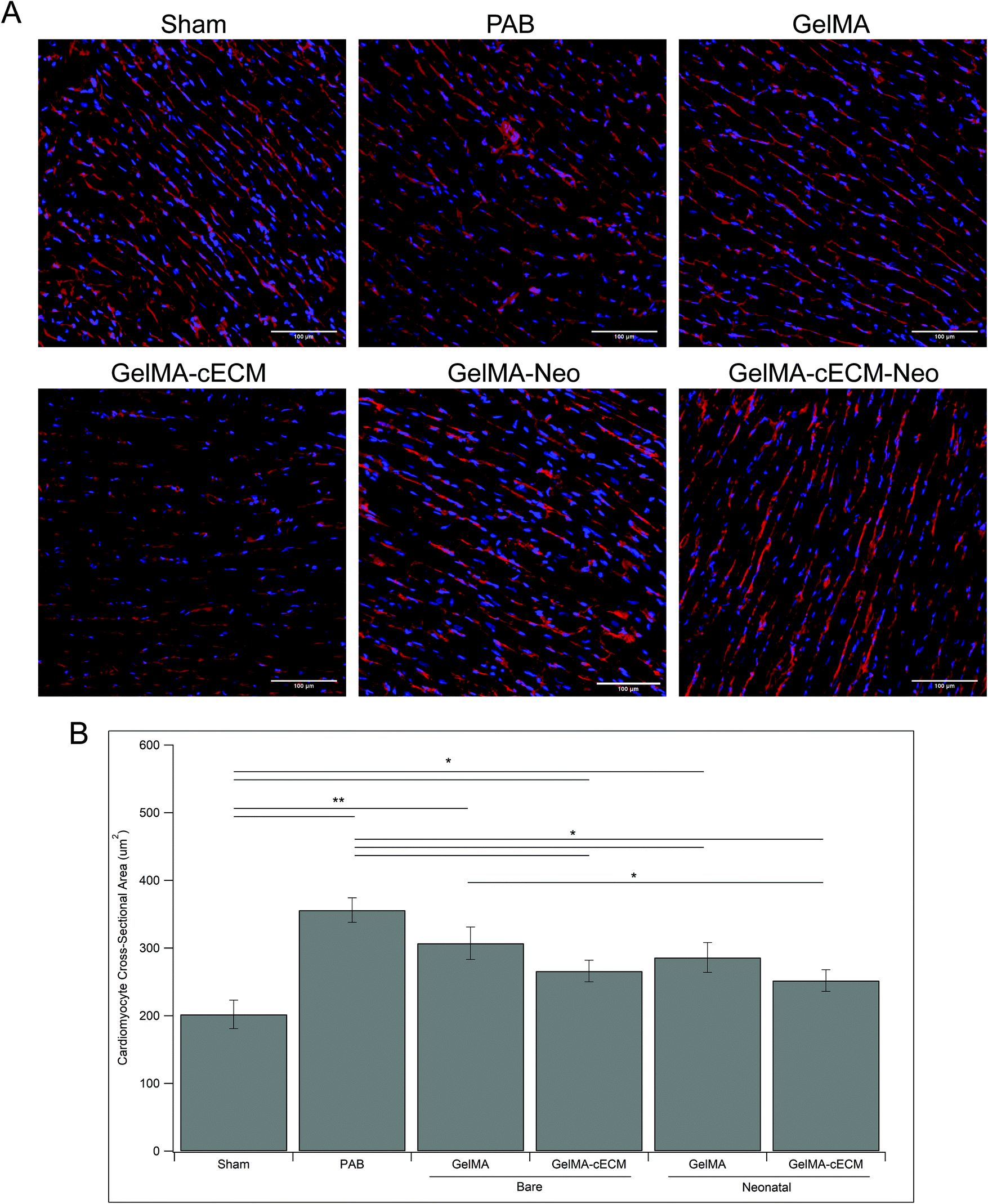 In vivo evaluation of bioprinted cardiac patches composed of  cardiac-specific extracellular matrix and progenitor cells in a model of  pediatric heart ... - Biomaterials Science (RSC Publishing)  DOI:10.1039/D1BM01539G