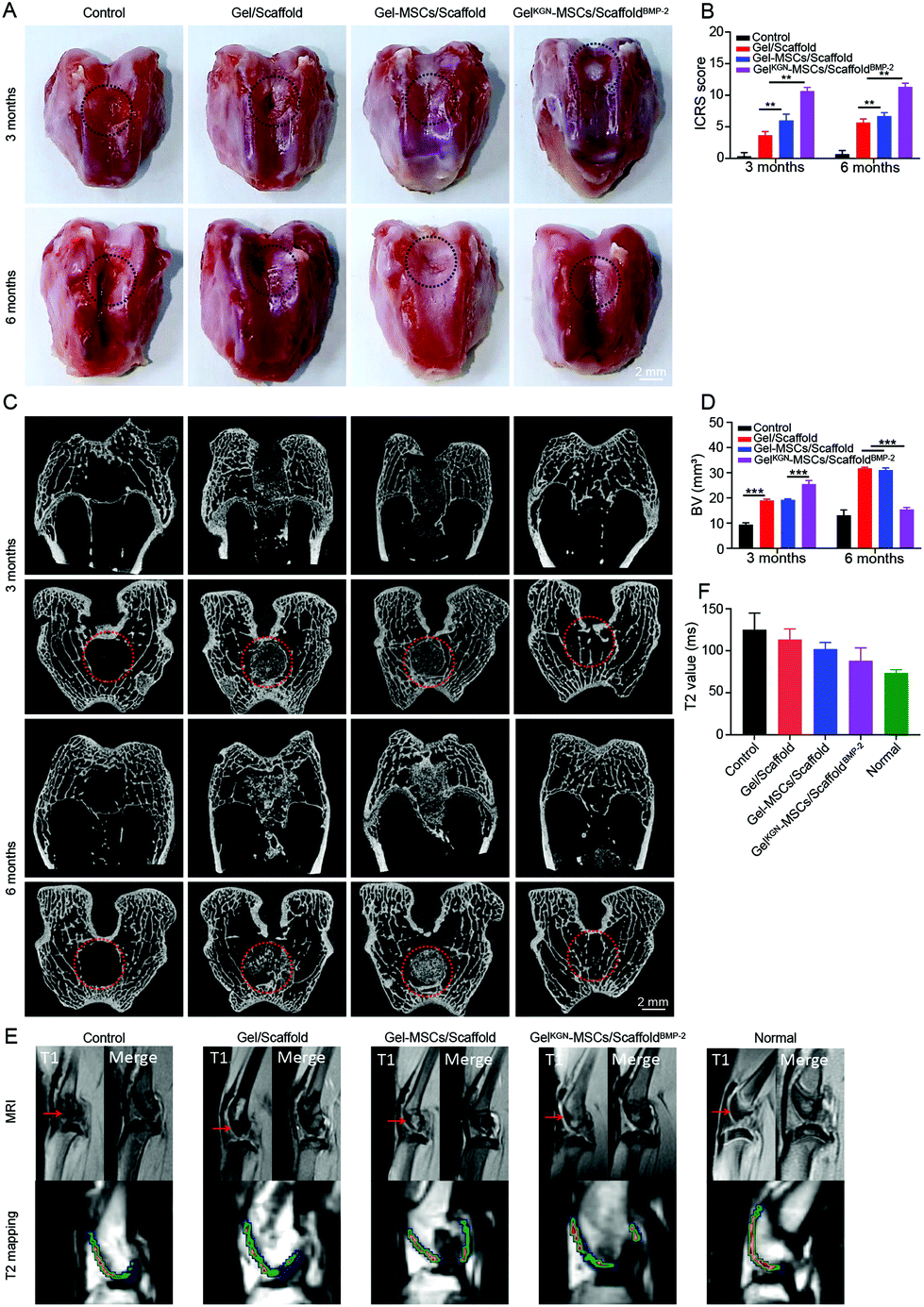Bionic biphasic composite scaffolds with osteochondrogenic Bionic biphasic composite scaffolds with osteochondrogenic