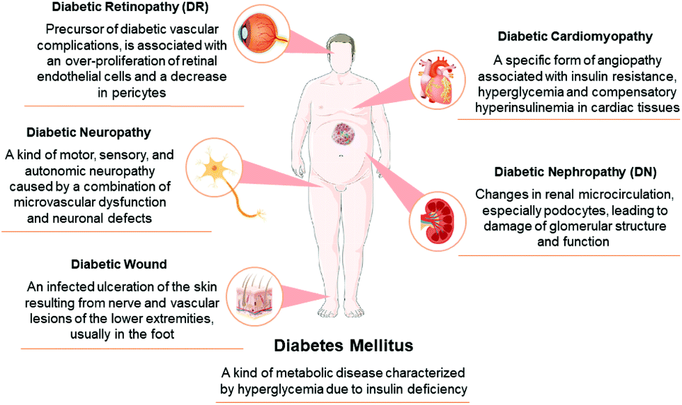 Exosomes for diabetes syndrome: ongoing applications and Exosomes for diabetes syndrome: ongoing applications and