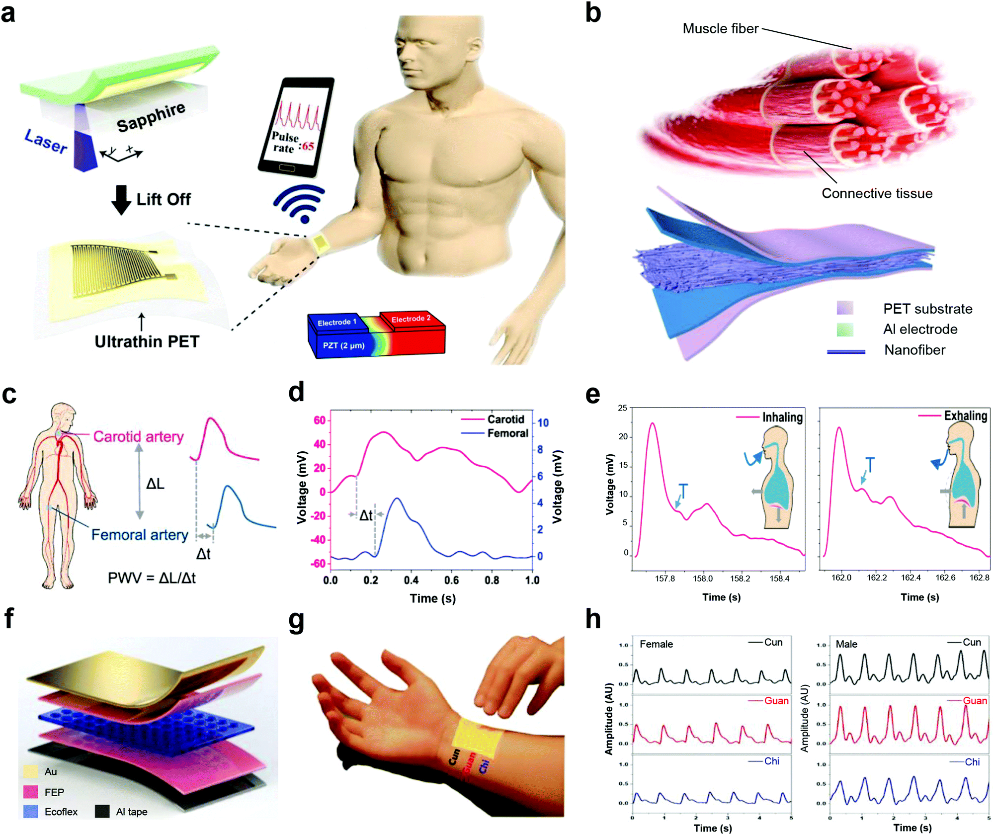 Piezoelectric nanogenerators for personalized healthcare - Chemical Society  Reviews (RSC Publishing) DOI:10.1039/D1CS00858G