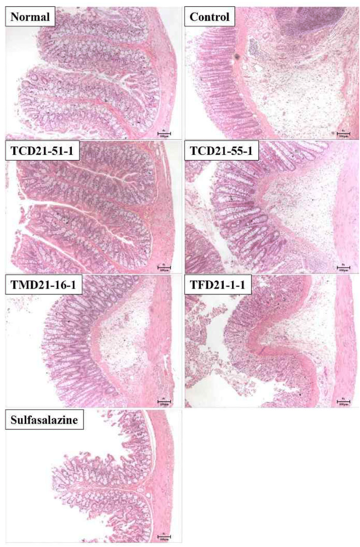 Protective effect of traditional Korean fermented soybean