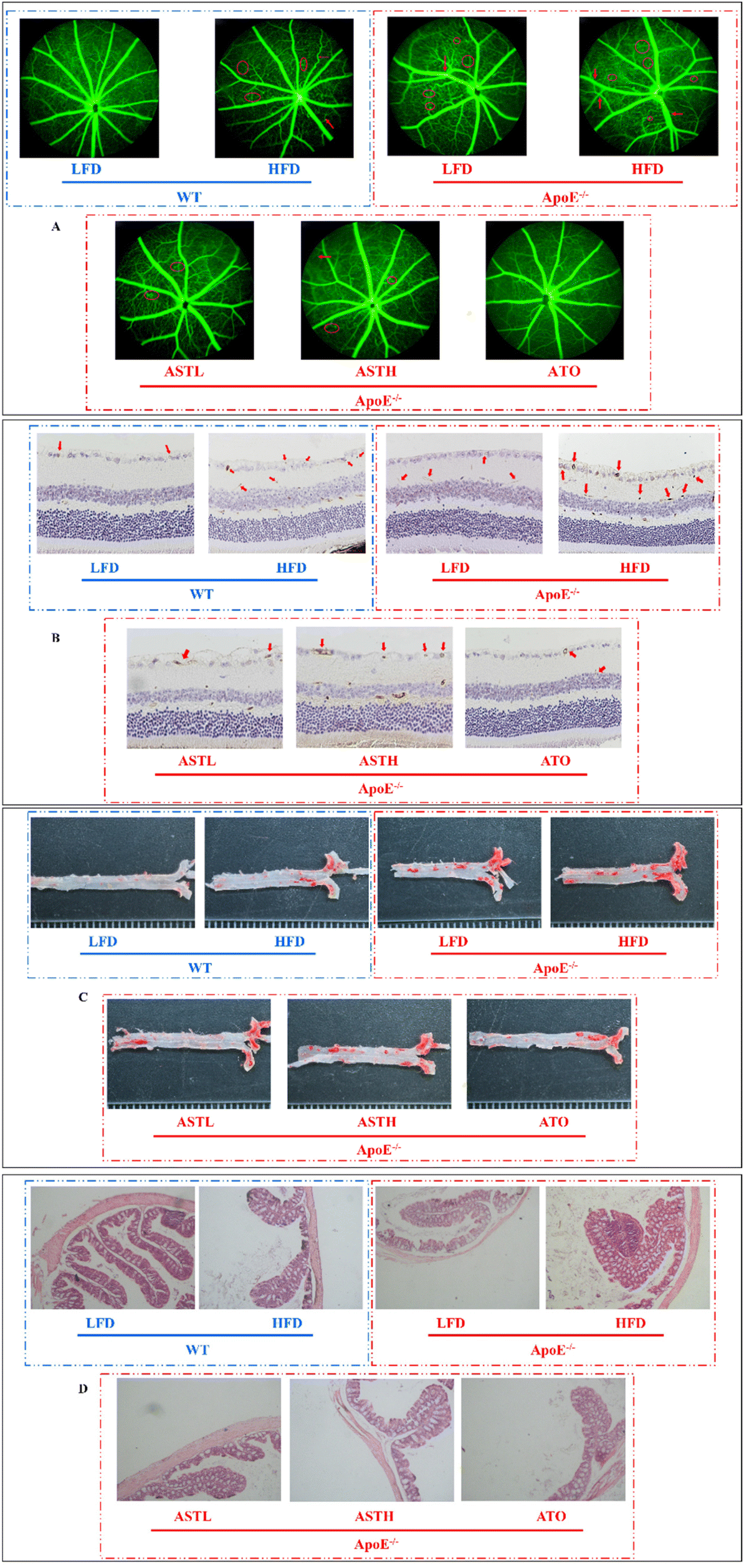 Dietary astaxanthin-rich extract ameliorates atherosclerosis