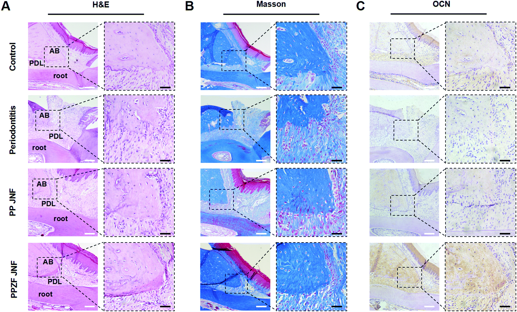 A periodontal tissue regeneration strategy via biphasic release of zeolitic  imidazolate framework-8 and FK506 using a uniaxial electrospun Janus nanof   - Journal of Materials Chemistry B (RSC Publishing)  DOI:10.1039/D1TB02174E