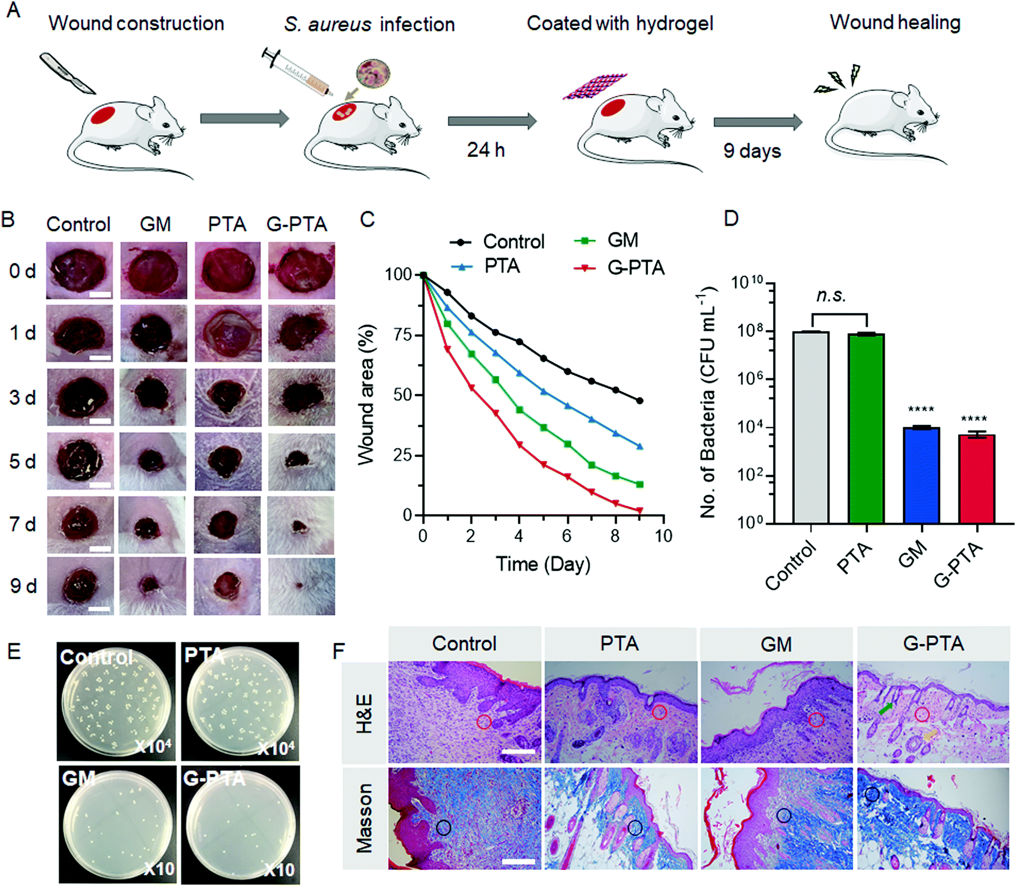 A gentamicin-thioctic acid multifunctional hydrogel for 