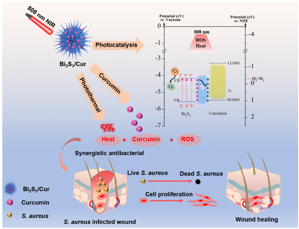 Sea urchin-like Bi 2 S 3 /curcumin heterojunction rapidly kills ...