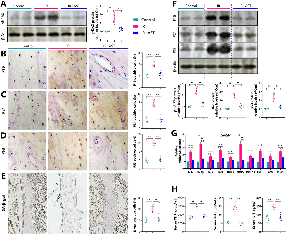 Astaxanthin attenuates irradiationinduced osteoporosis in mice by