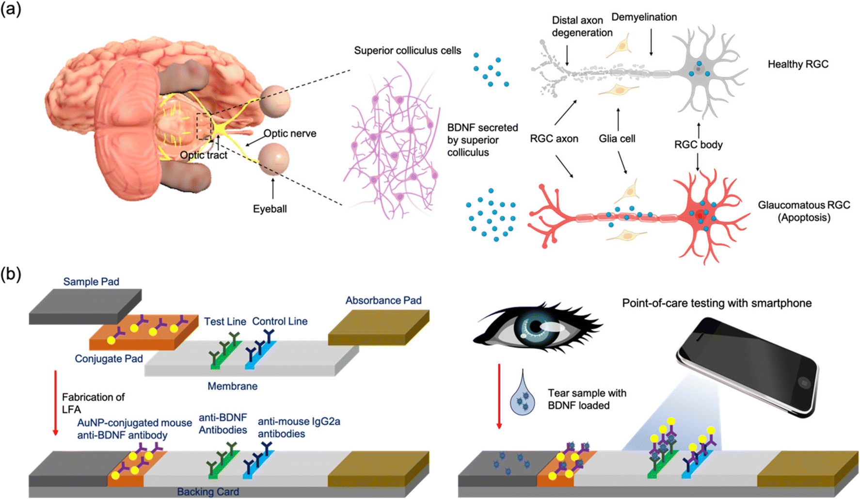 Quantitative Brain-derived Neurotrophic Factor Lateral Flow Assay For ...