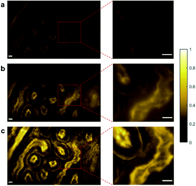 Plasmonic Random Laser Enabled Artefact Free Wide Field Fluorescence Bioimaging Uncovering