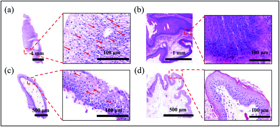 One-step coordination of metal–phenolic networks as antibacterial ...