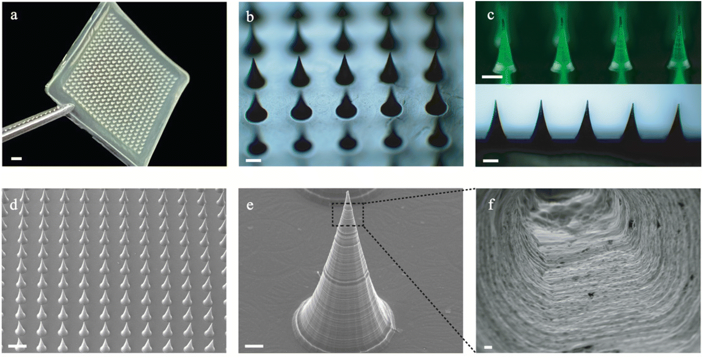 A mechanically tough and ultra-swellable microneedle for acute gout ...
