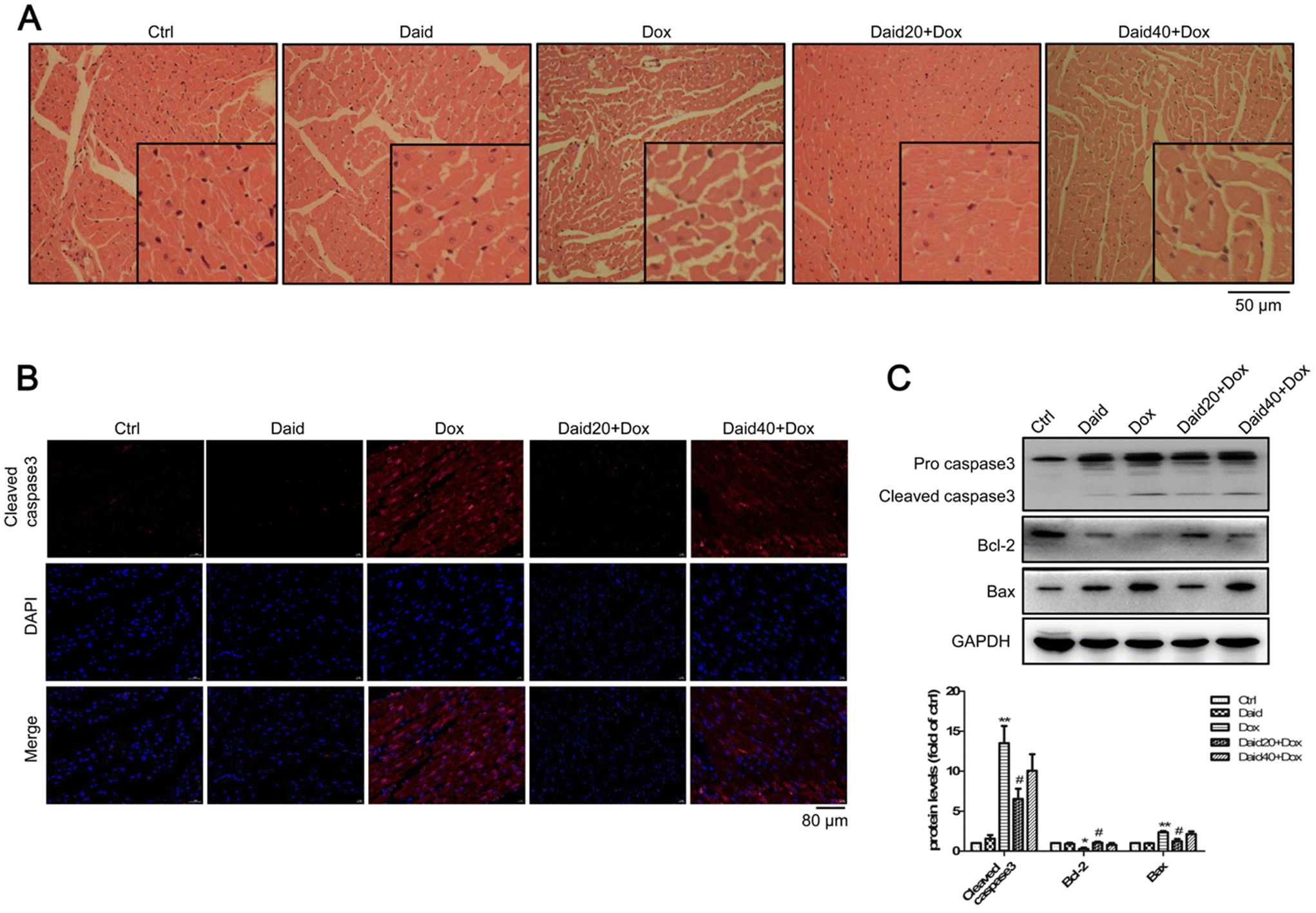Ultrahigh-Sensitivity Detection of 17β-Estradiol