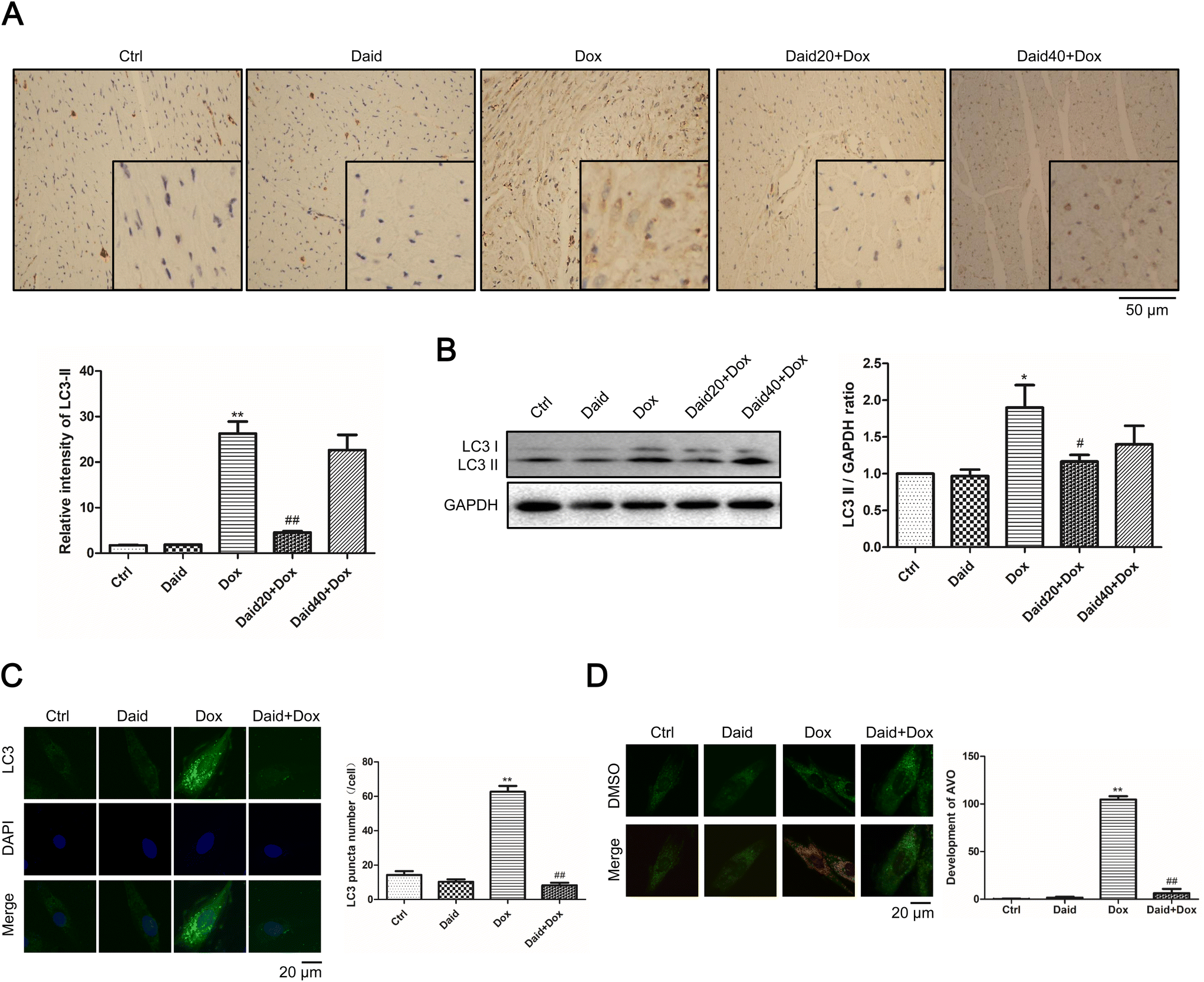 Daidzein ameliorates doxorubicin-induced cardiac injury by