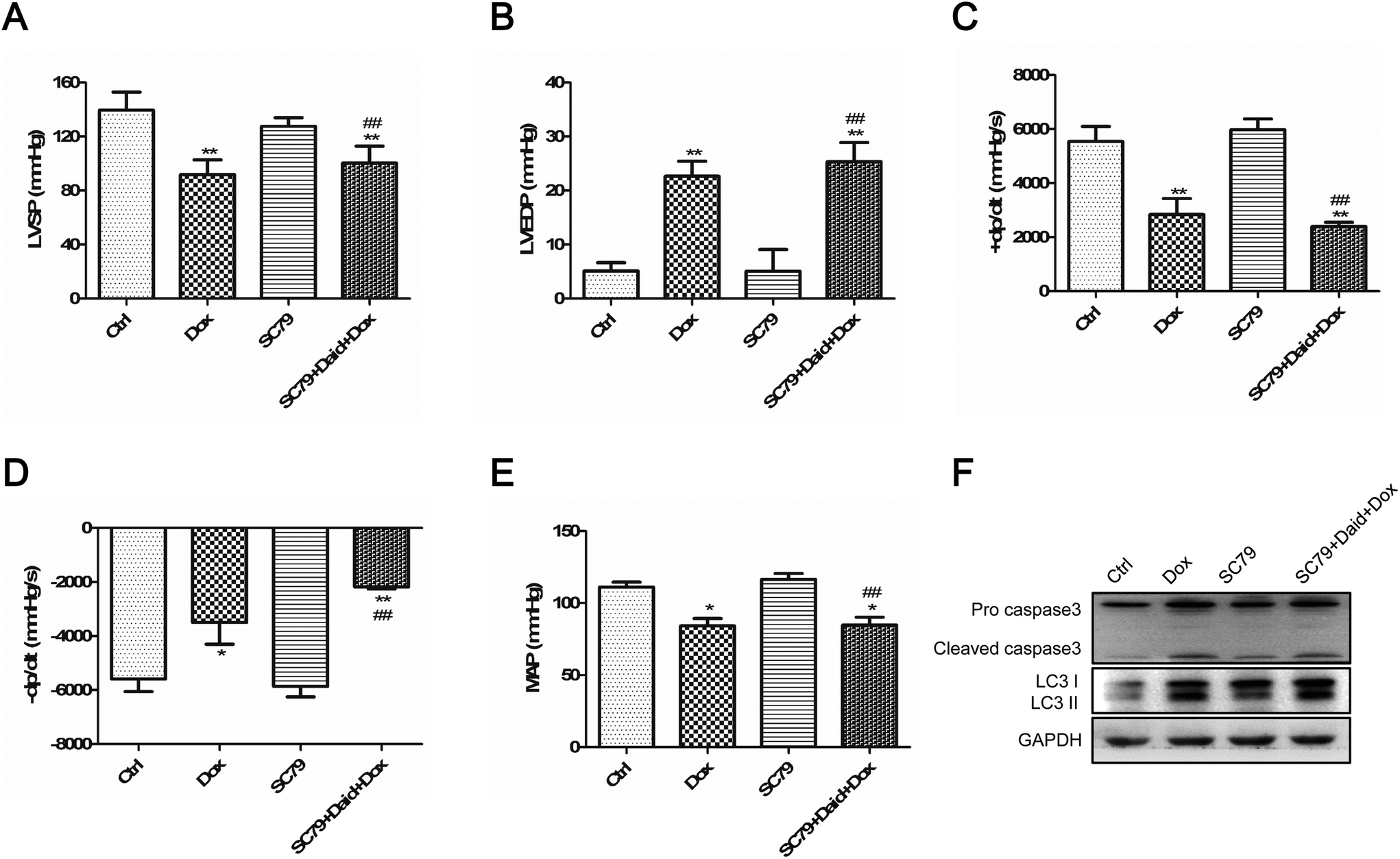 Daidzein ameliorates doxorubicin-induced cardiac injury by