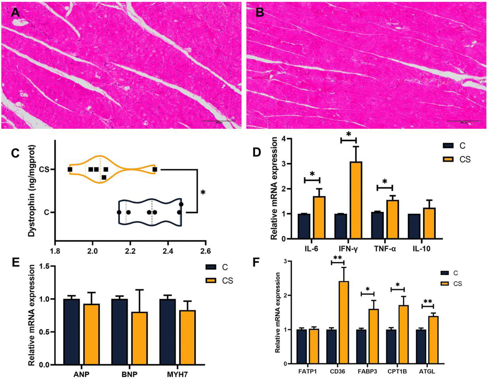 Ren Dietary full-fat rice bran prevents the risk of heart ferroptosis