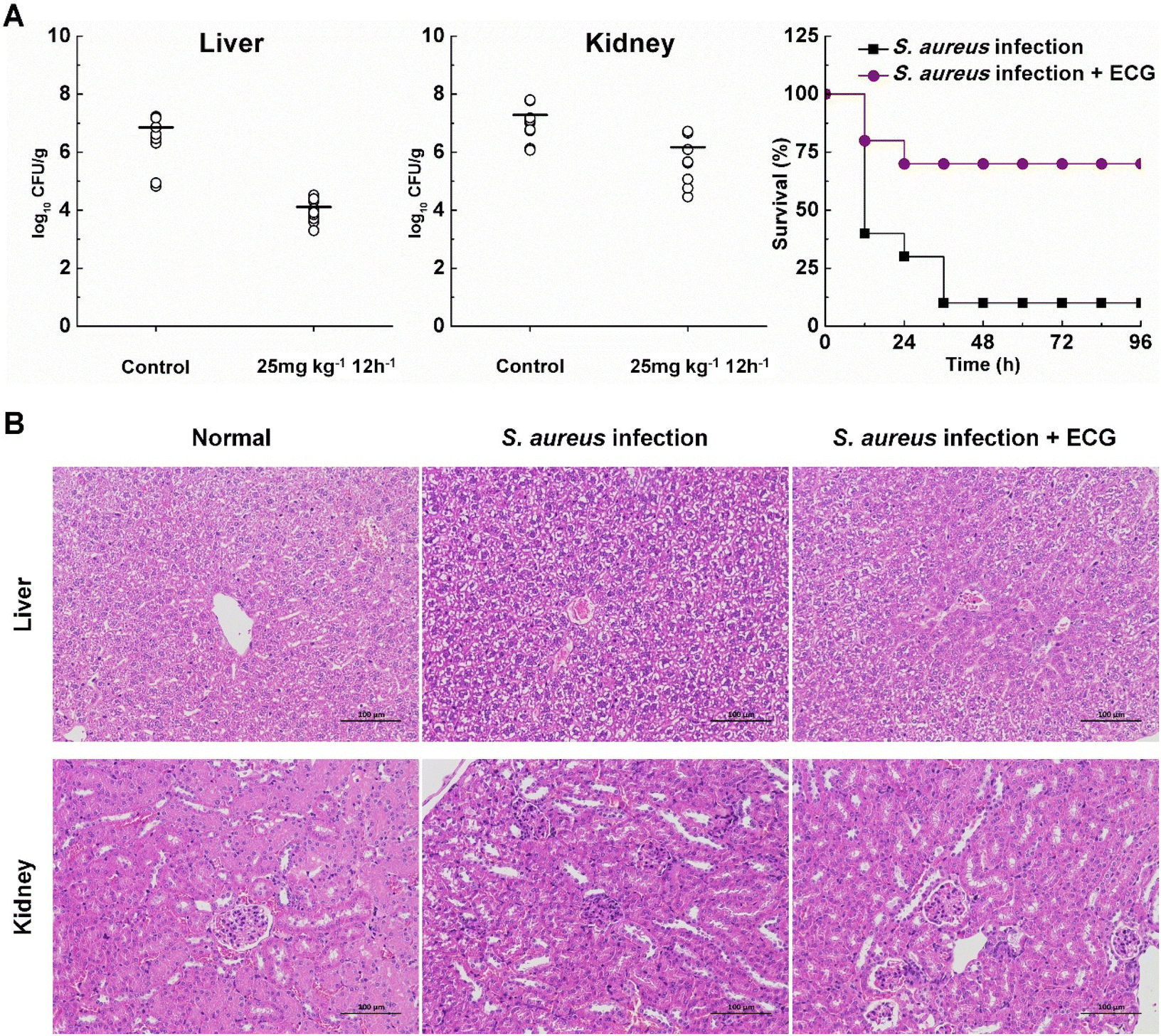 Molecular Pathogenesis of Staphylococcus aureus Infection