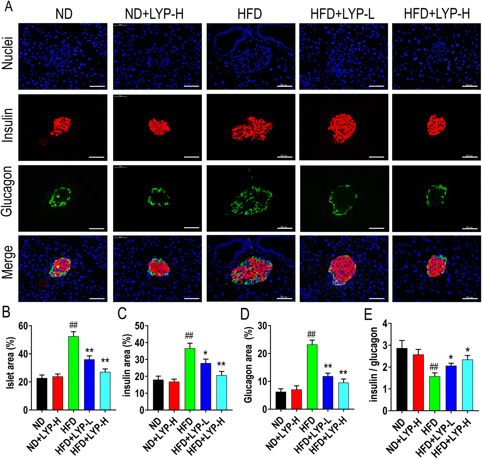 Large yellow tea polysaccharides ameliorate obesity