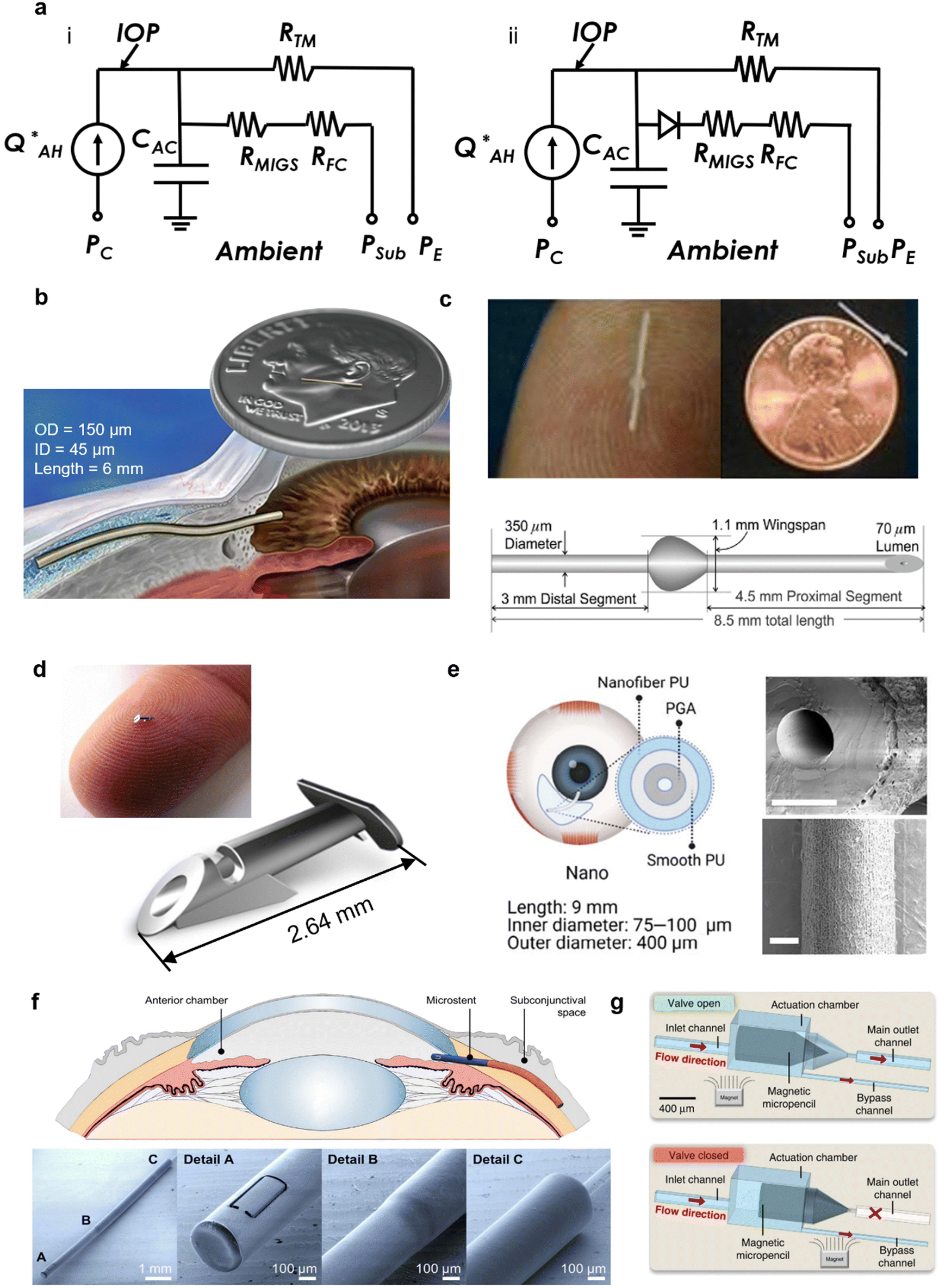 Microfluidics in the eye: a review of glaucoma implants from an engineering  perspective - Lab on a Chip (RSC Publishing) DOI:10.1039/D3LC00407D