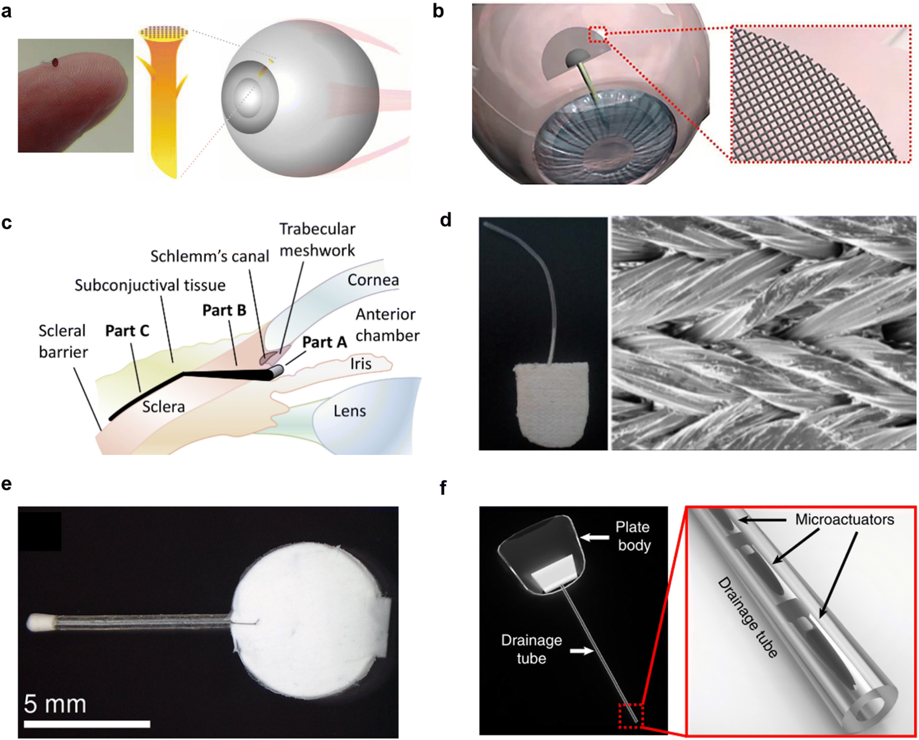 Microfluidics in the eye: a review of glaucoma implants from an