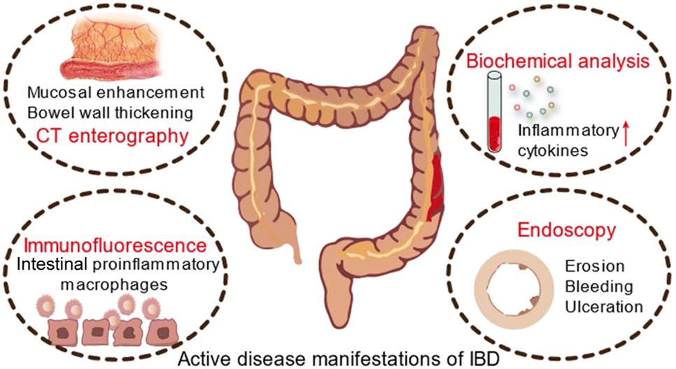 Structure design mechanisms and inflammatory disease applications of ...