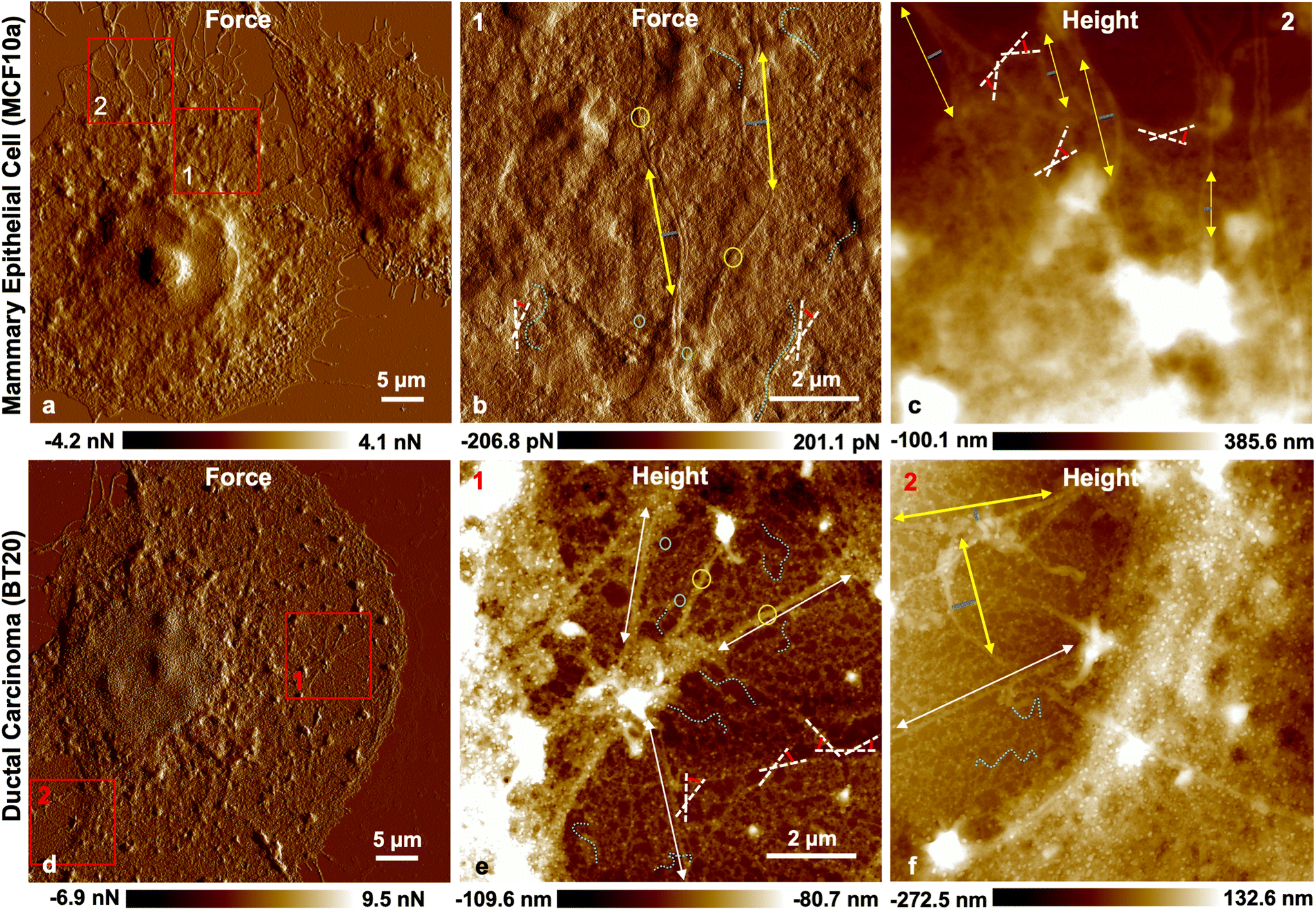 Schematic diagram of a crisscross network of polymeric meshes. (a