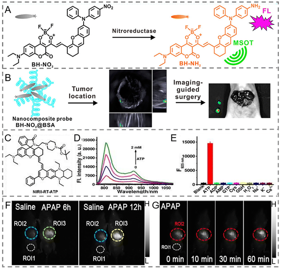 Recent advances in activatable NIR-II organic fluorophores for