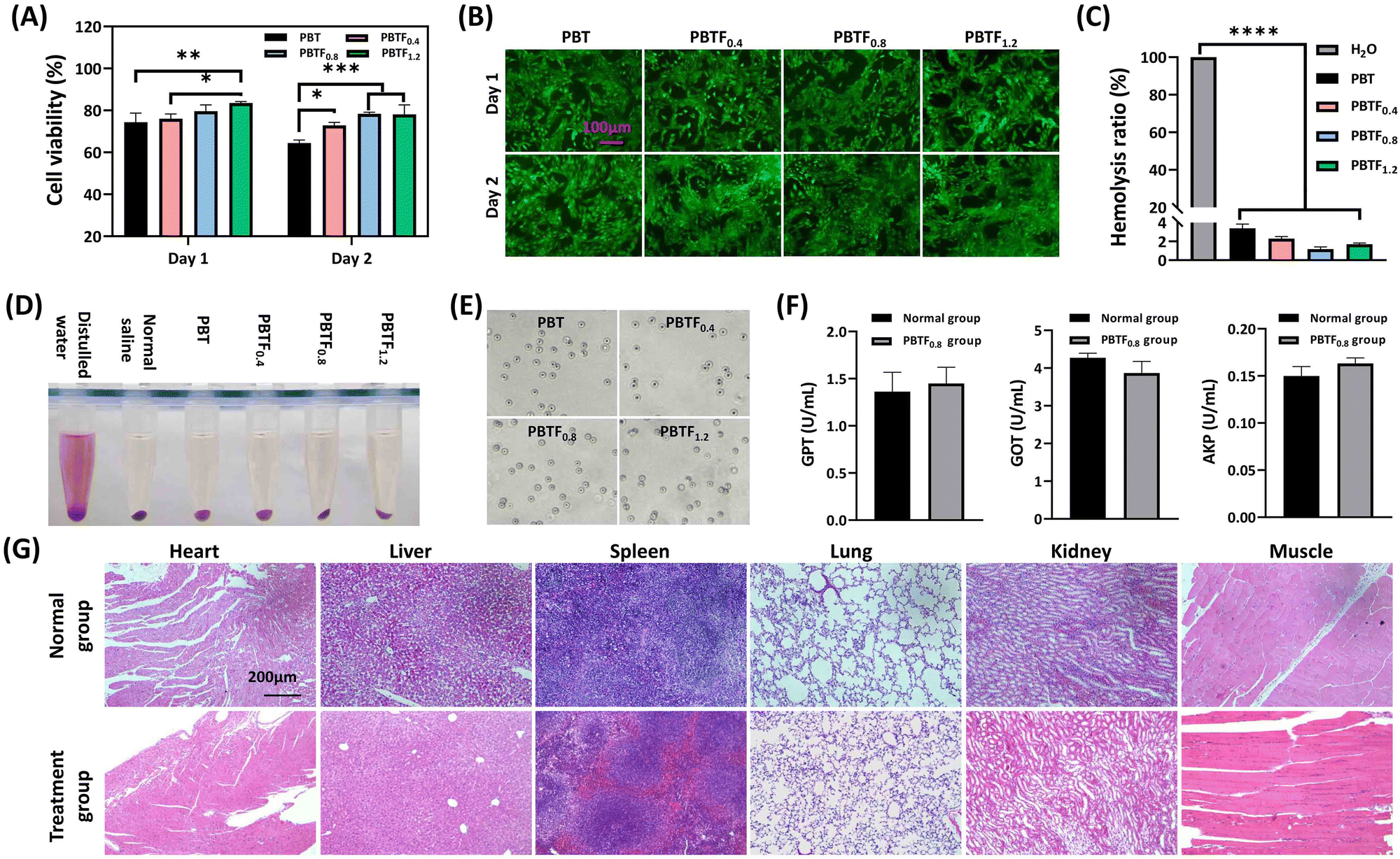 A multifunctional hydrogel dressing with high tensile and adhesive 