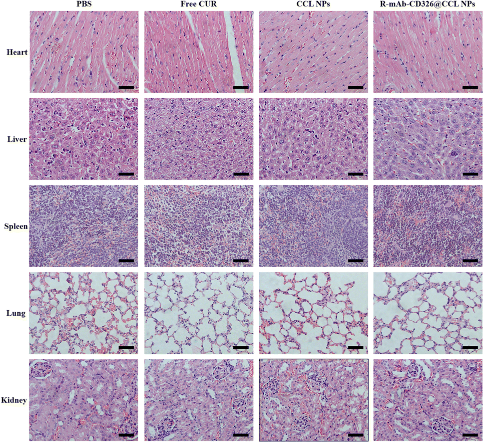 A CD326 monoclonal antibody modified core cross-linked A CD326 monoclonal antibody modified core cross-linked