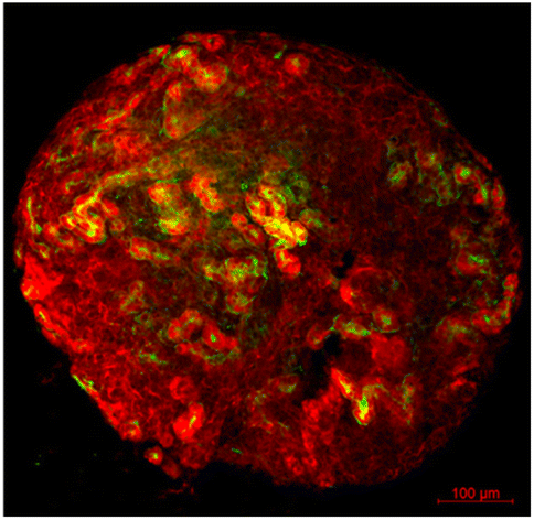 Renal tissue engineering for regenerative medicine using polymers and ...