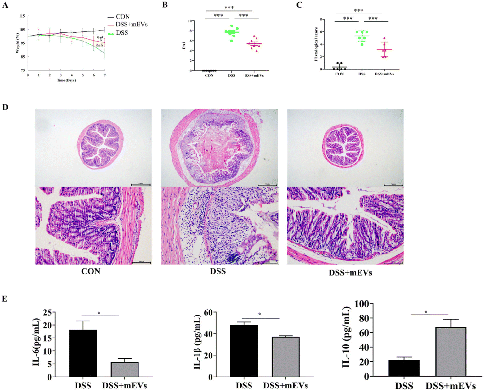 Bovine milkderived extracellular vesicles prevent gut inflammation by regulating lipid and