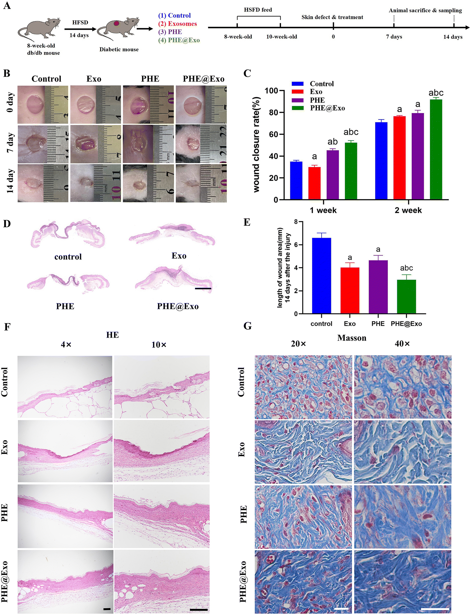 Local Transplantation Of GMSC-derived Exosomes To Promote Vascularized ...