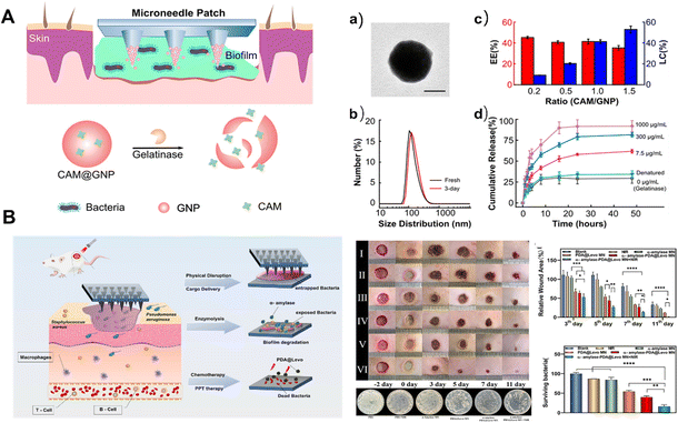 Smart microneedle patches for wound healing and management - Journal of ...
